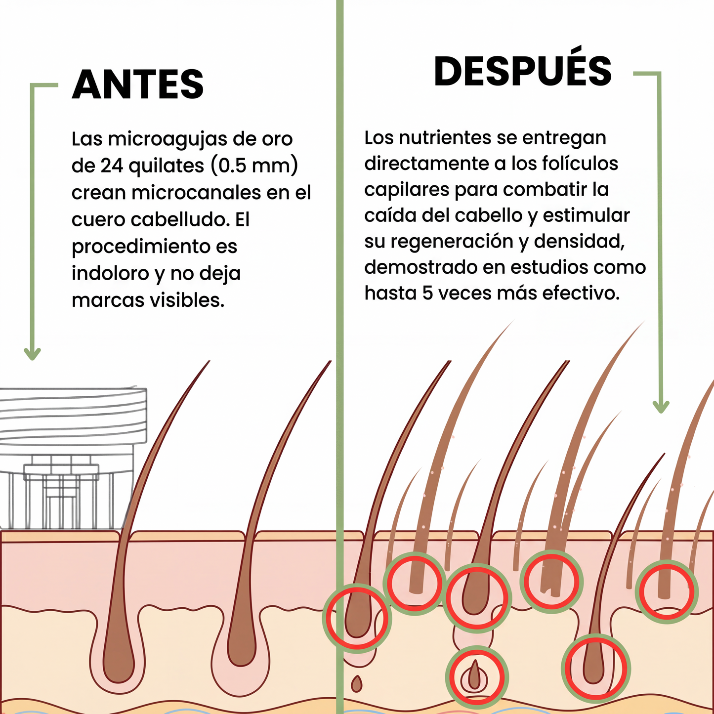 Growderm™ Estimula la Regeneración Capilar